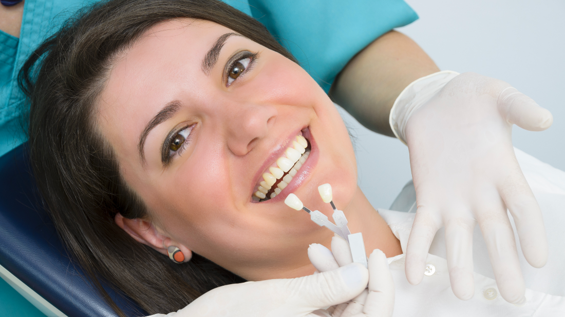 Southern Dental Group Blog Porcelain Veneers Somerset KY