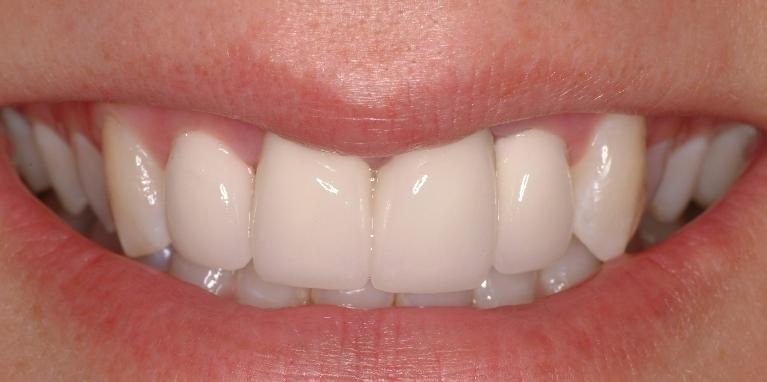 Cosmetic-Makeover-After-Image